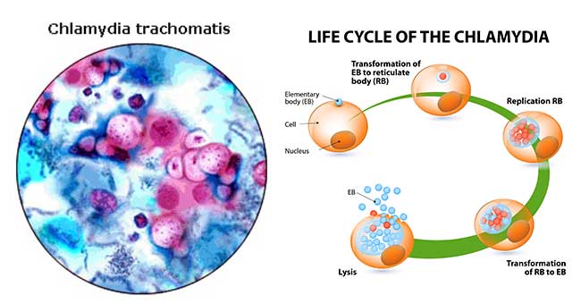 chlamydia trachomatis test