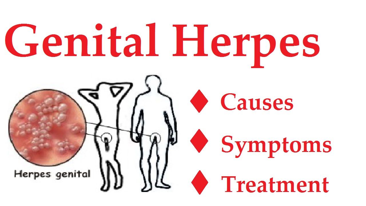 Genital Herpes Simplex 2